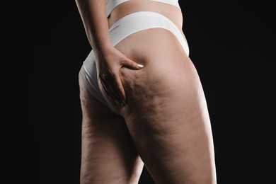 Photo of Woman with cellulite on black background, closeup