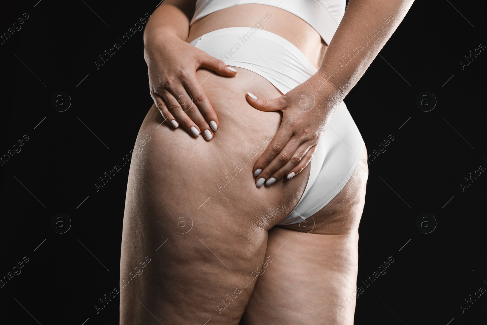 Photo of Woman with cellulite on black background, closeup