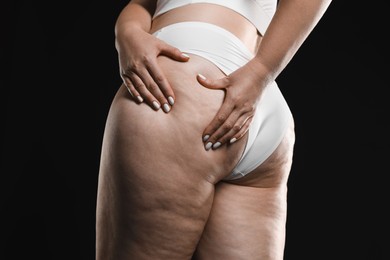 Woman with cellulite on black background, closeup