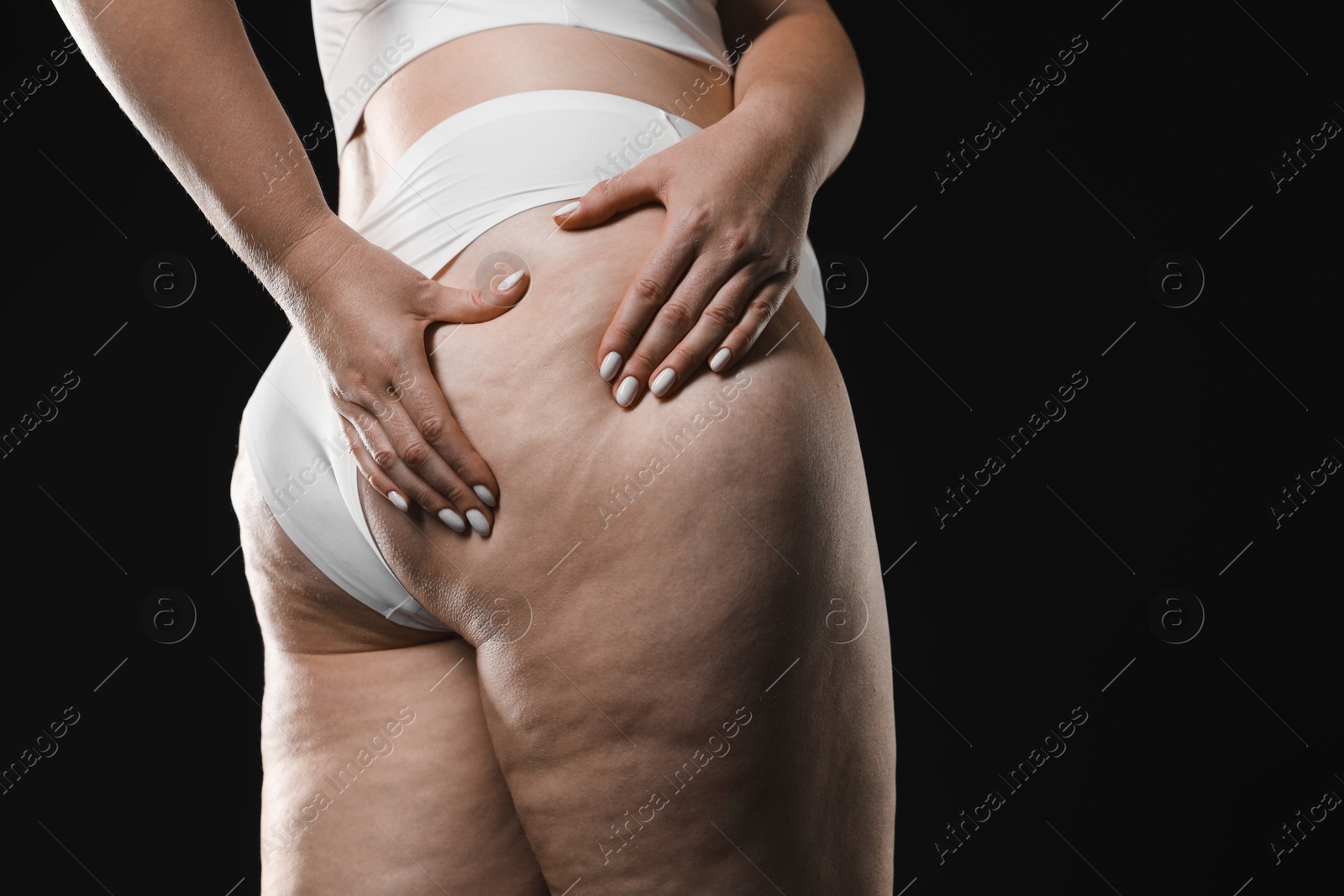 Photo of Woman with cellulite on black background, closeup. Space for text