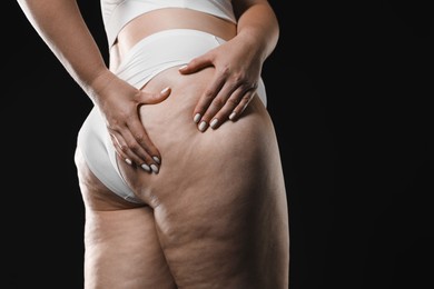 Woman with cellulite on black background, closeup. Space for text