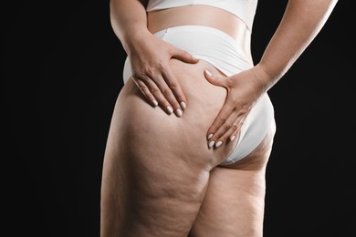 Woman with cellulite on black background, closeup