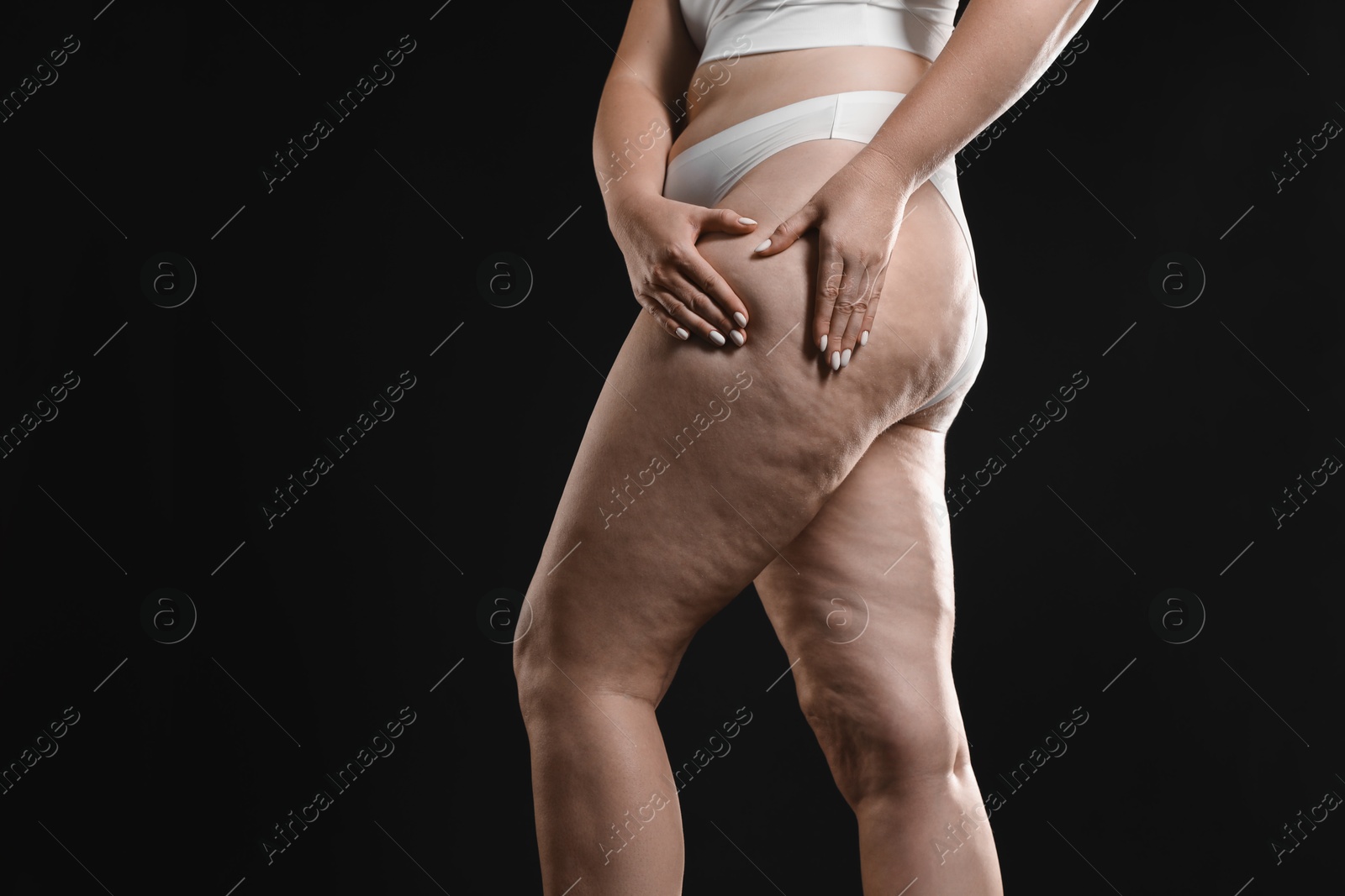 Photo of Woman with cellulite on black background, closeup. Space for text