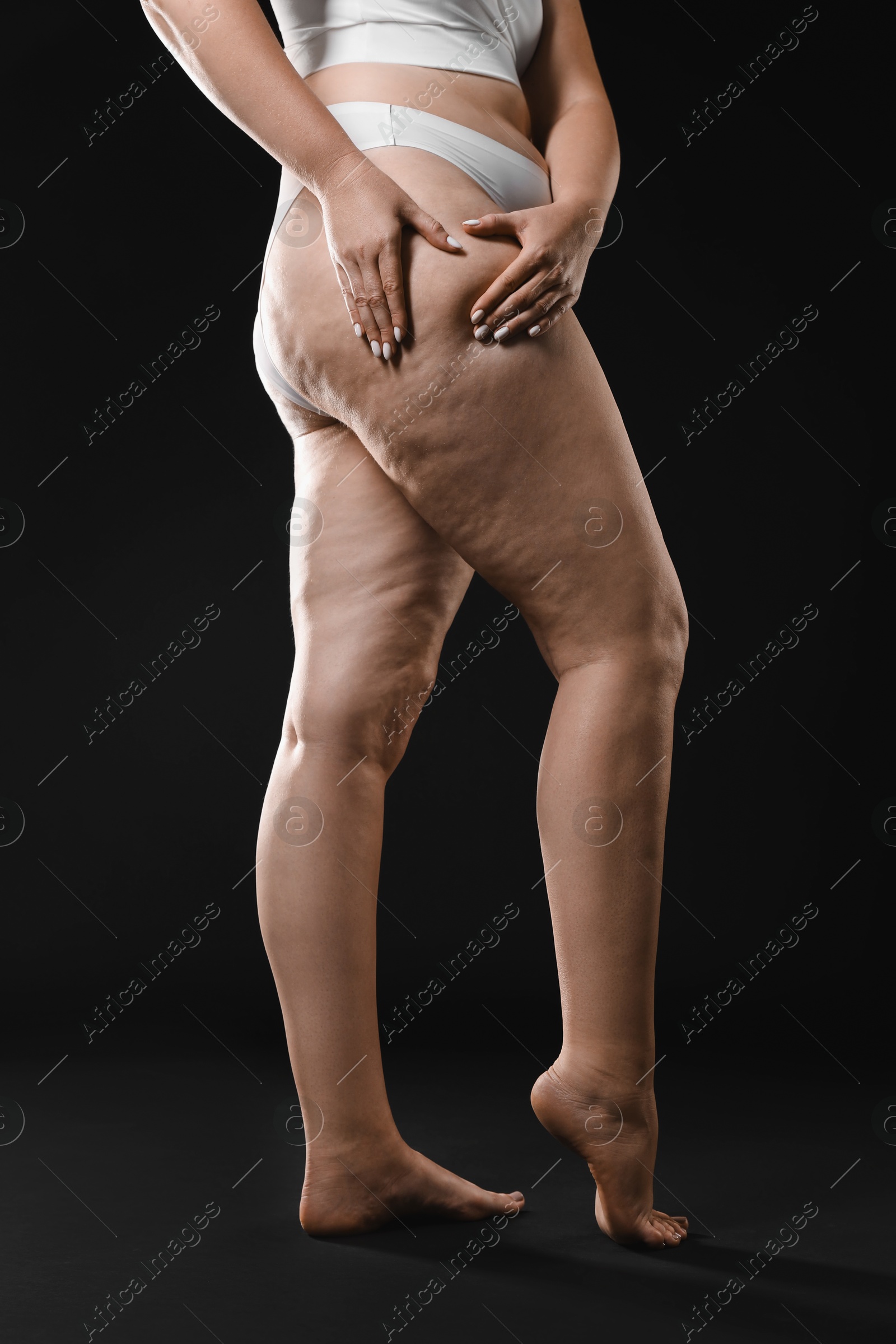 Photo of Woman with cellulite on black background, closeup