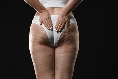 Woman with cellulite on black background, closeup