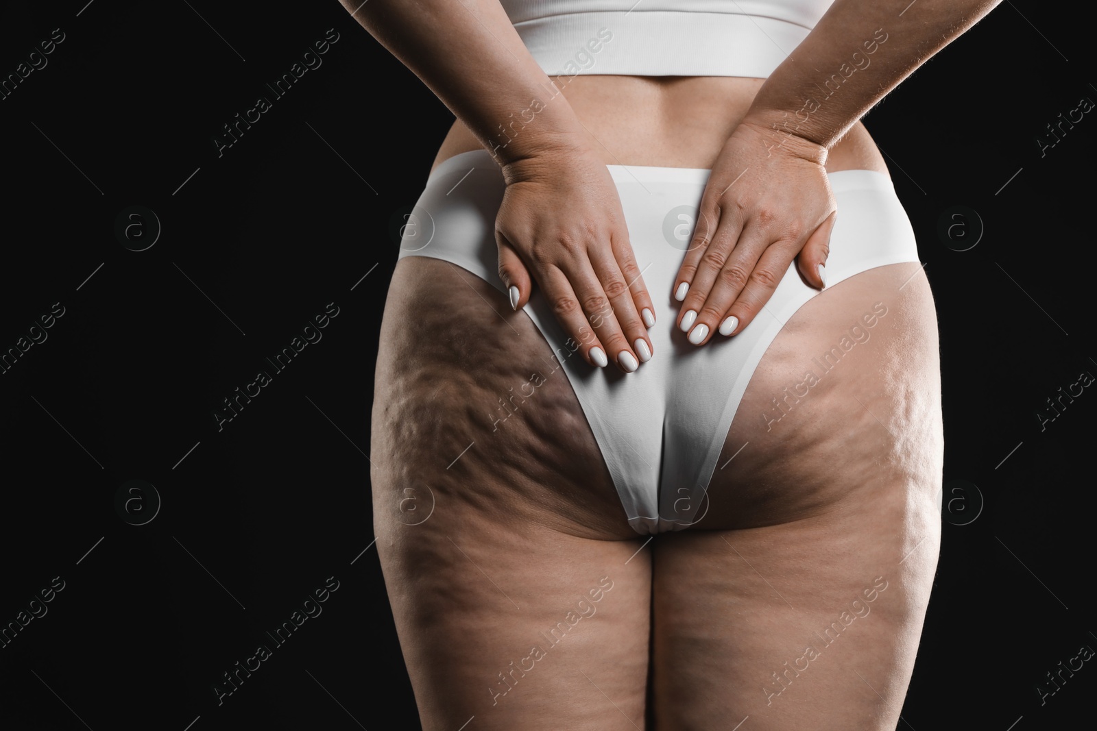 Photo of Woman with cellulite on black background, closeup