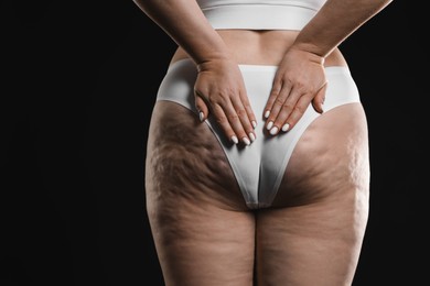 Woman with cellulite on black background, closeup