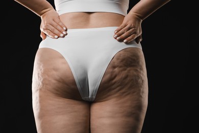 Photo of Woman with cellulite on black background, closeup