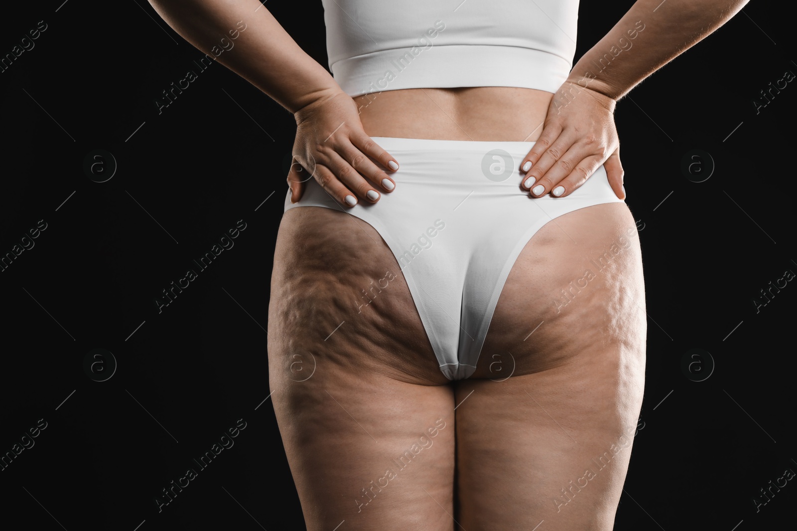 Photo of Woman with cellulite on black background, closeup