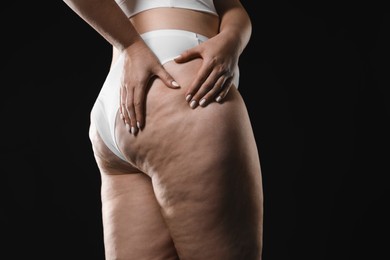 Photo of Woman with cellulite on black background, closeup. Space for text