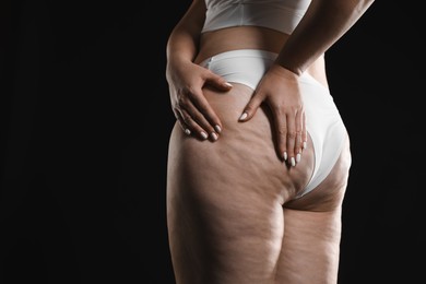 Woman with cellulite on black background, closeup. Space for text