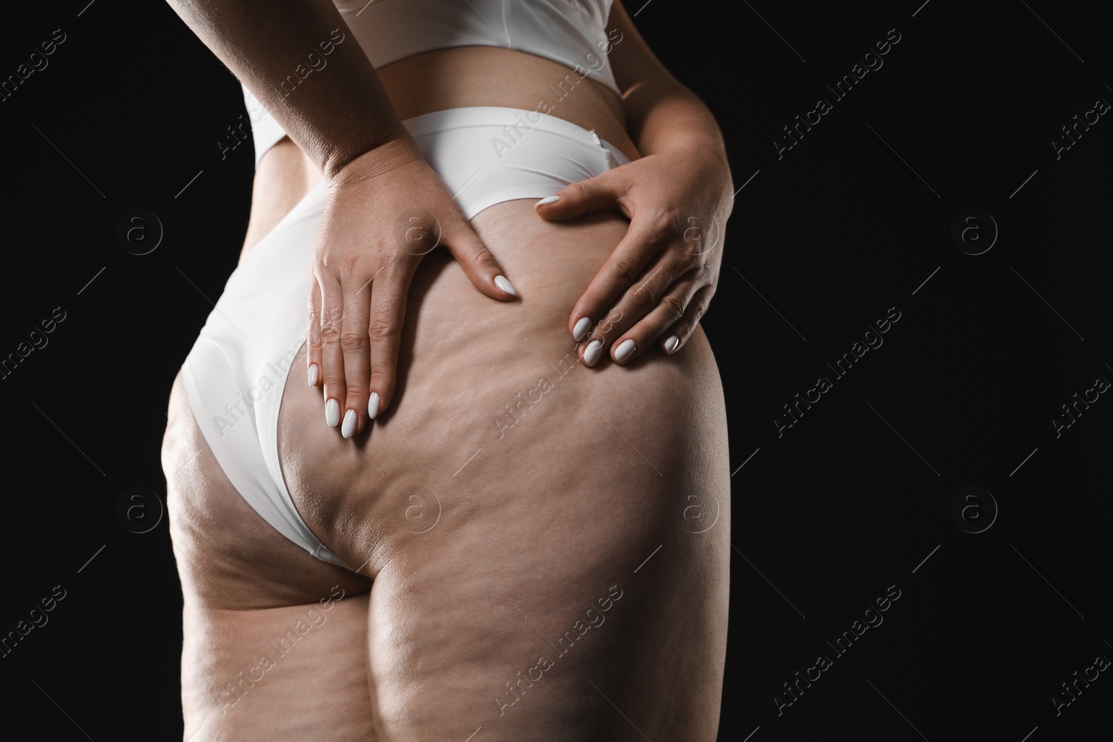 Photo of Woman with cellulite on black background, closeup. Space for text