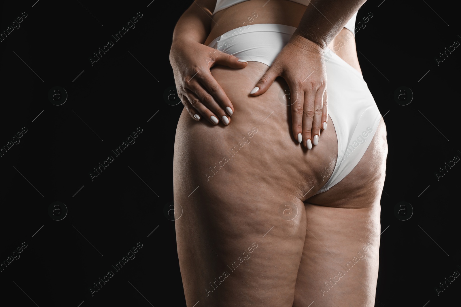 Photo of Woman with cellulite on black background, closeup. Space for text