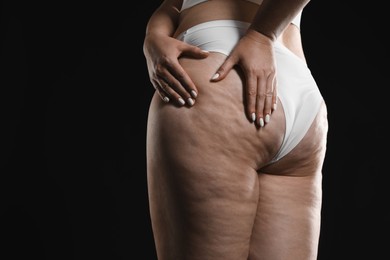 Woman with cellulite on black background, closeup. Space for text