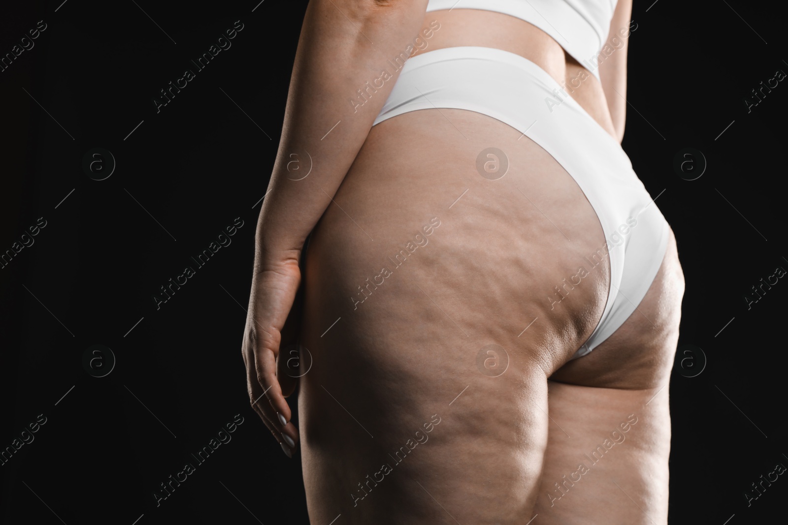 Photo of Woman with cellulite on black background, closeup. Space for text