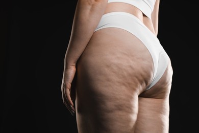 Photo of Woman with cellulite on black background, closeup. Space for text