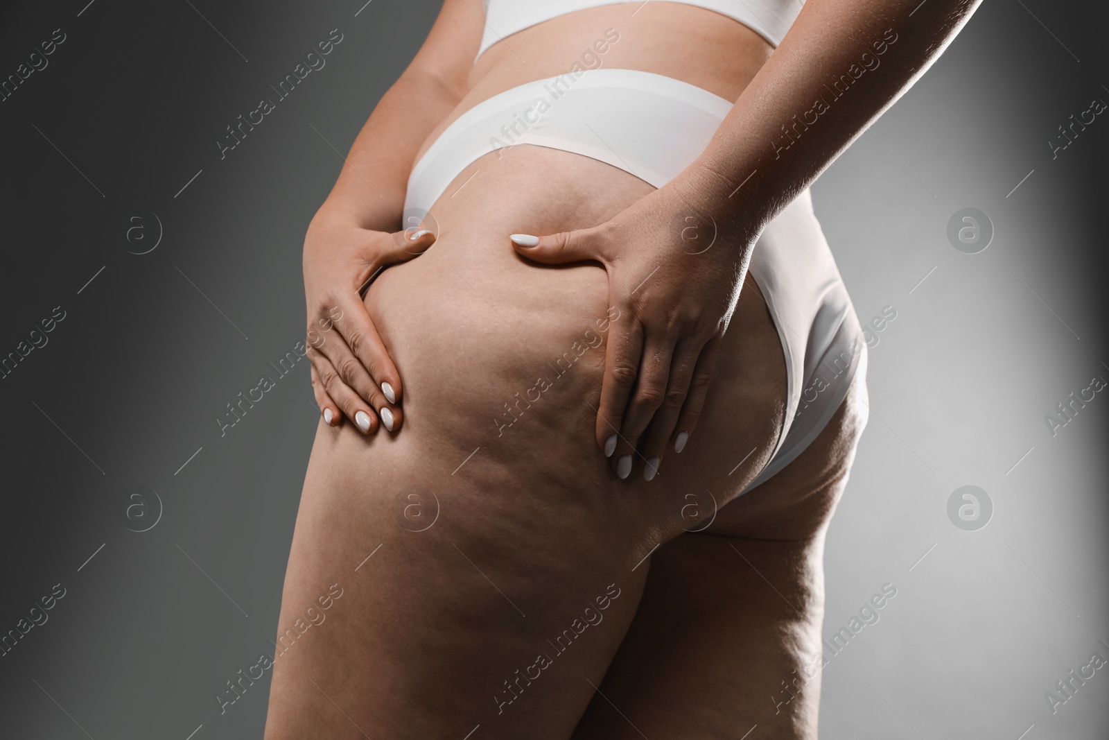 Photo of Woman with cellulite on grey background, closeup