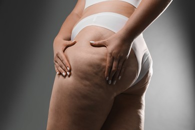 Photo of Woman with cellulite on grey background, closeup