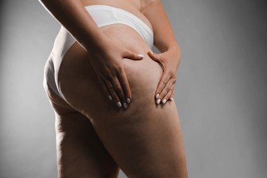 Photo of Woman with cellulite on grey background, closeup