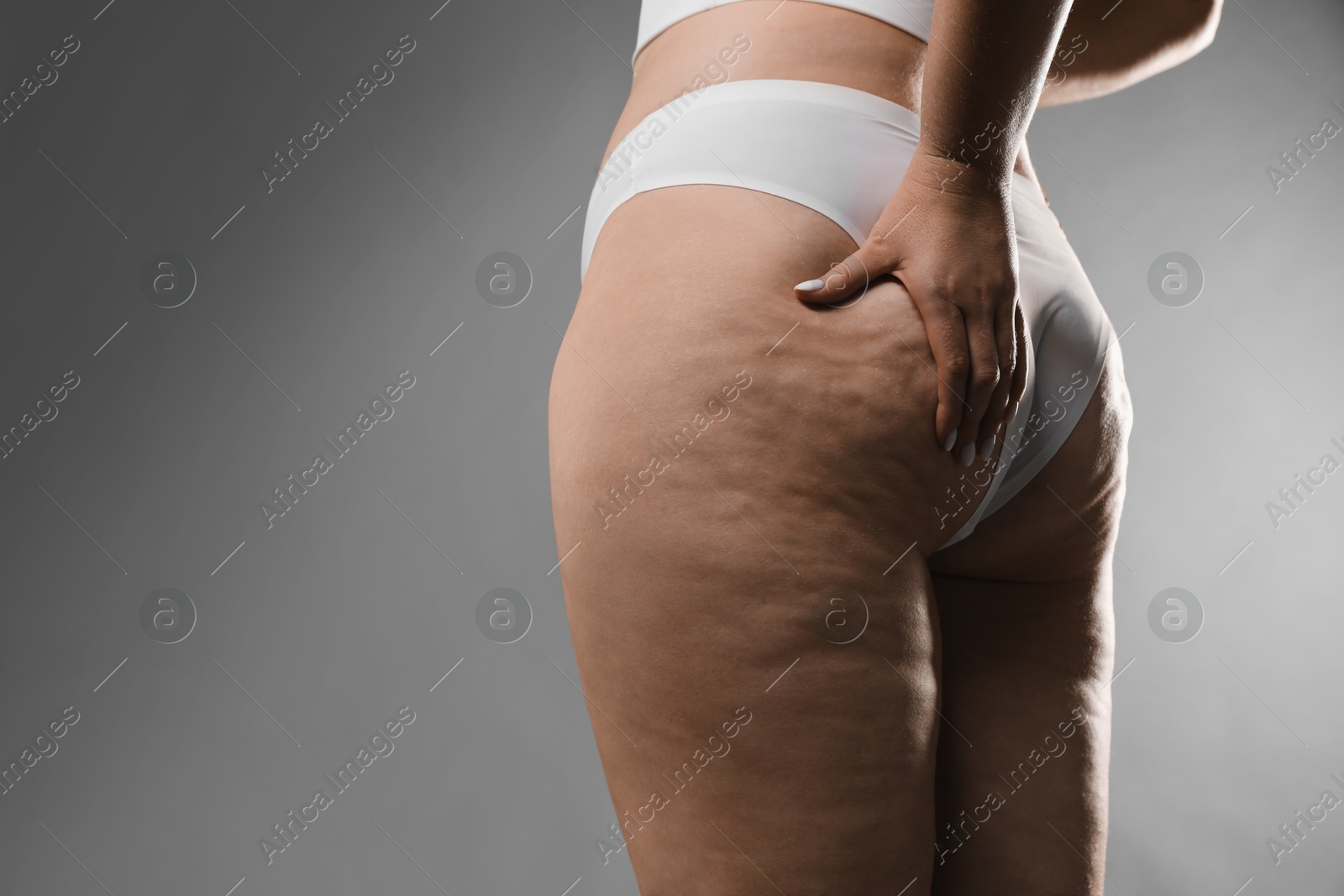 Photo of Woman with cellulite on grey background, closeup. Space for text