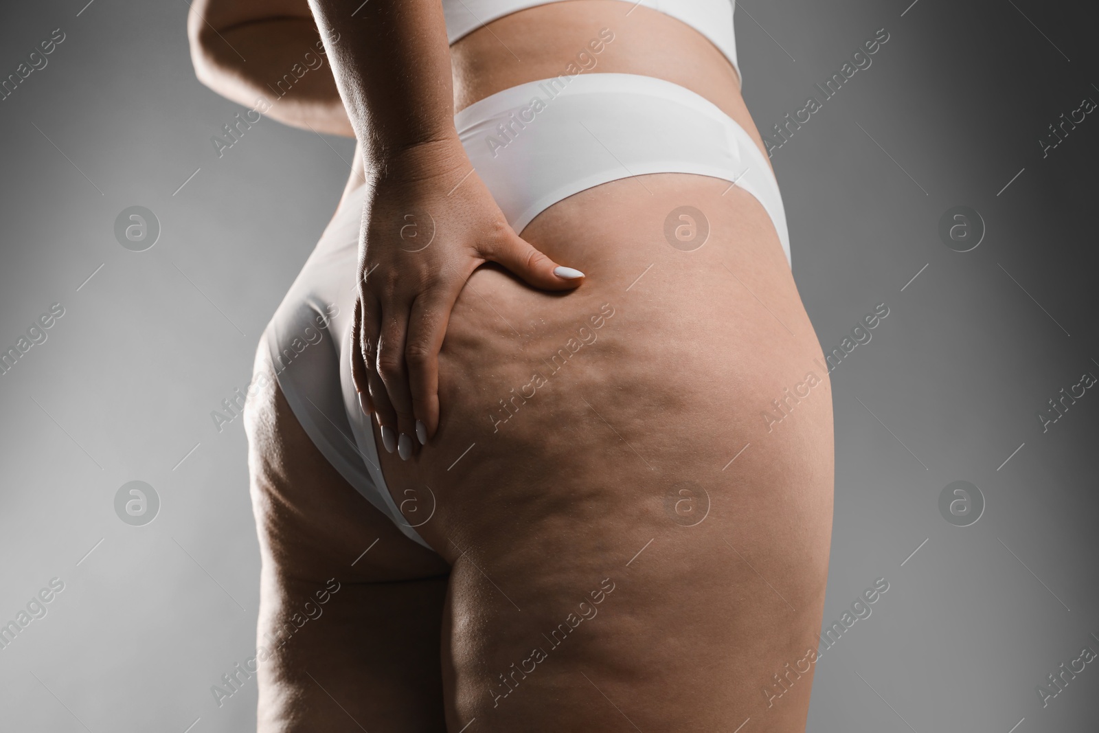 Photo of Woman with cellulite on grey background, closeup