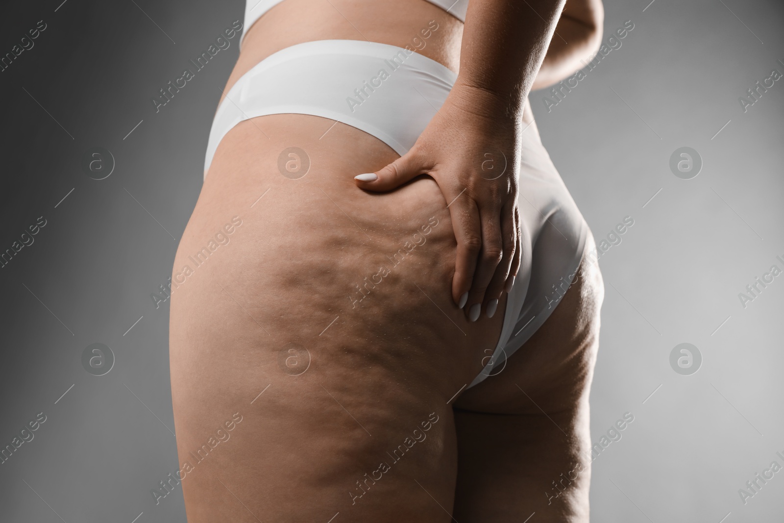 Photo of Woman with cellulite on grey background, closeup