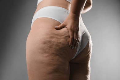 Photo of Woman with cellulite on grey background, closeup