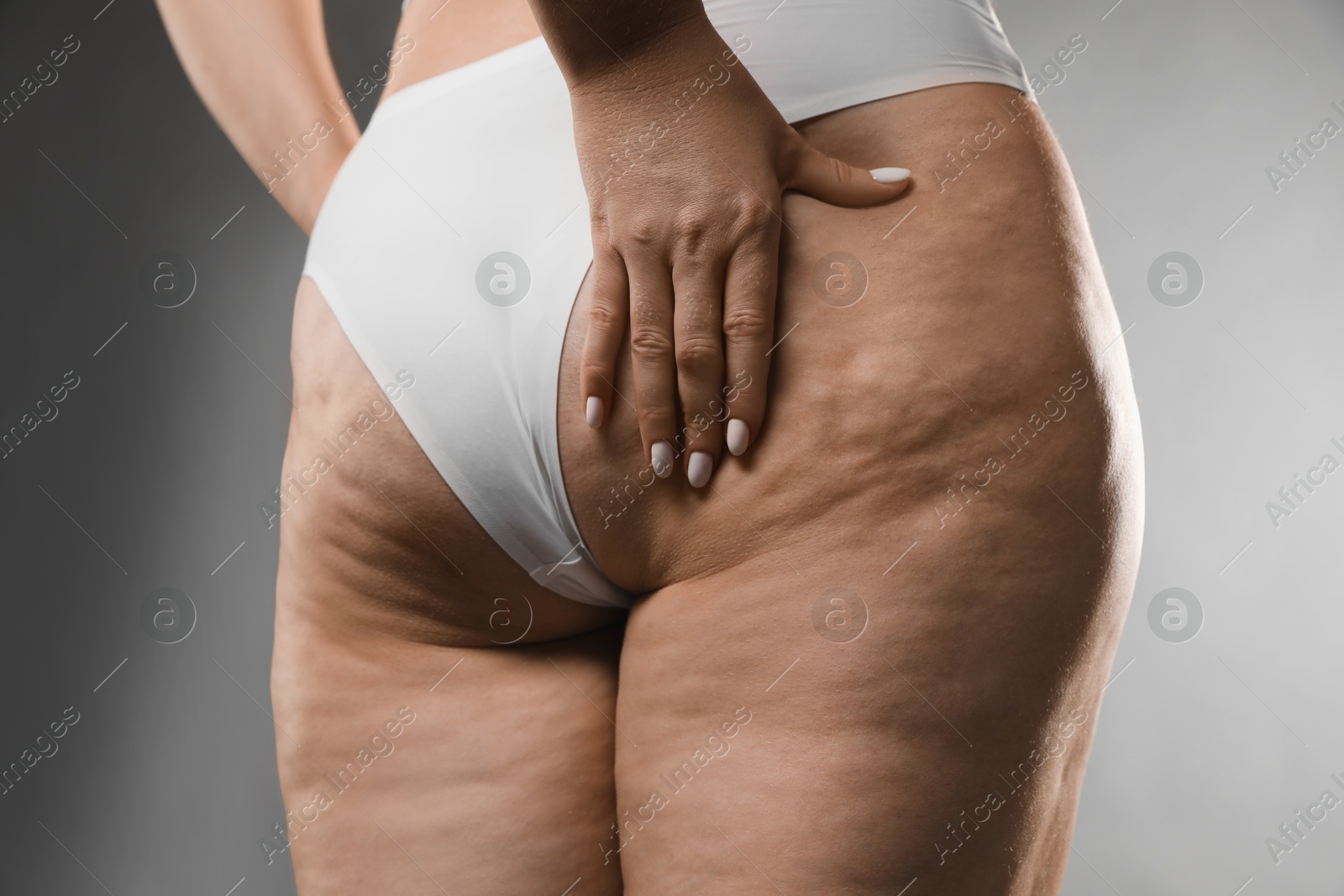 Photo of Woman with cellulite on grey background, closeup