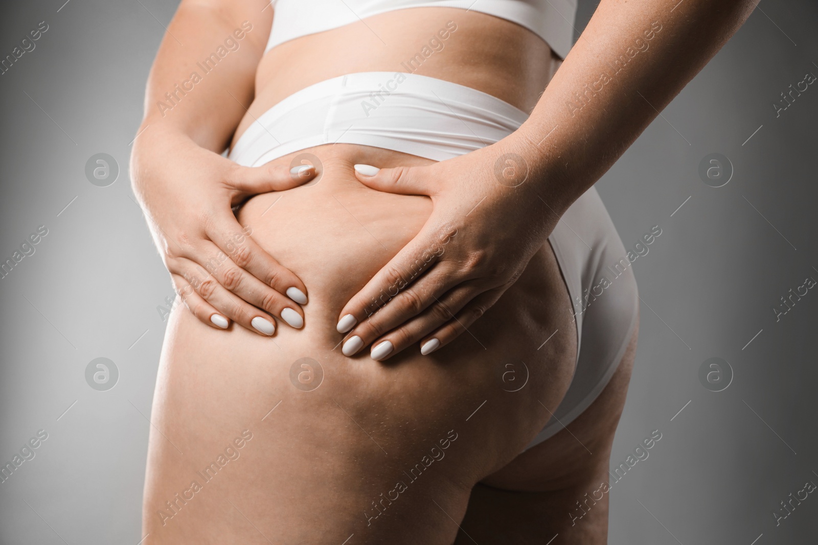 Photo of Woman with cellulite on grey background, closeup