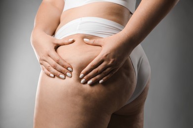 Woman with cellulite on grey background, closeup