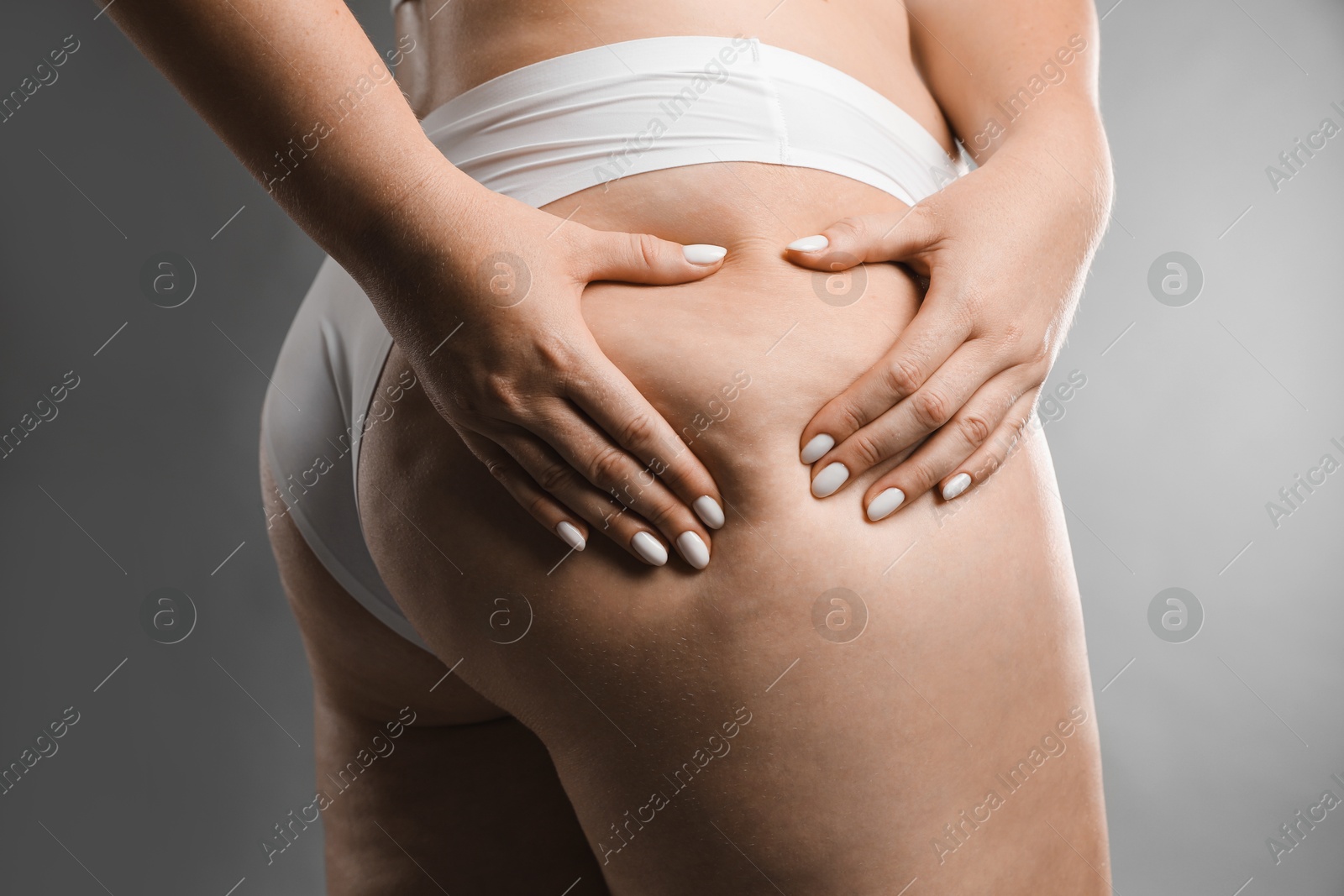 Photo of Woman with cellulite on grey background, closeup