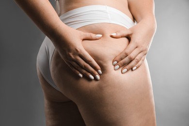 Woman with cellulite on grey background, closeup