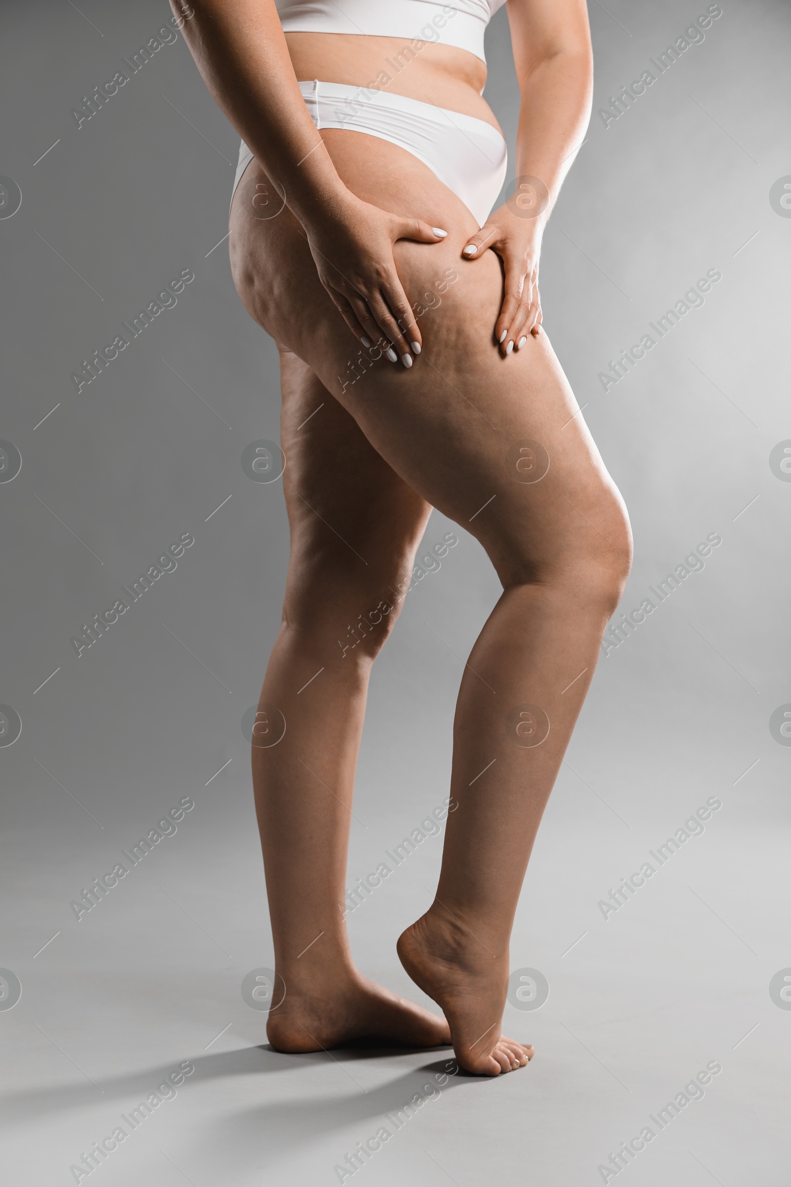 Photo of Woman with cellulite on grey background, closeup