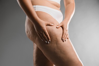 Photo of Woman with cellulite on grey background, closeup