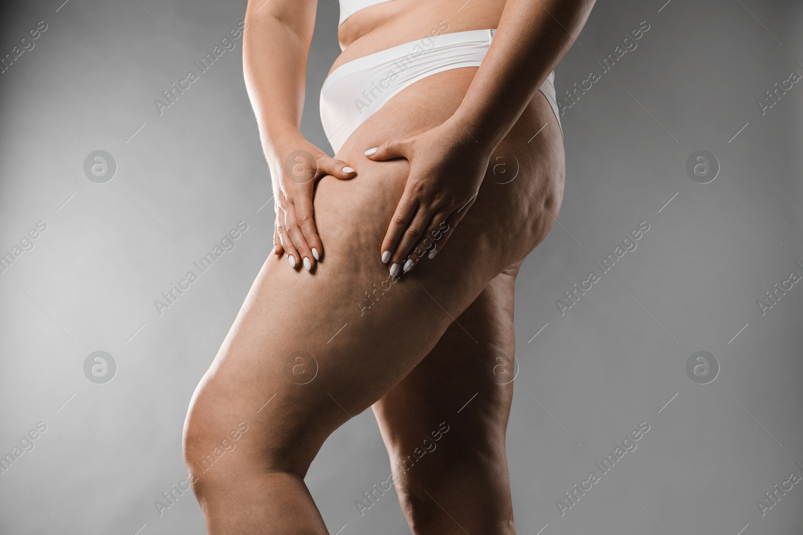 Photo of Woman with cellulite on grey background, closeup