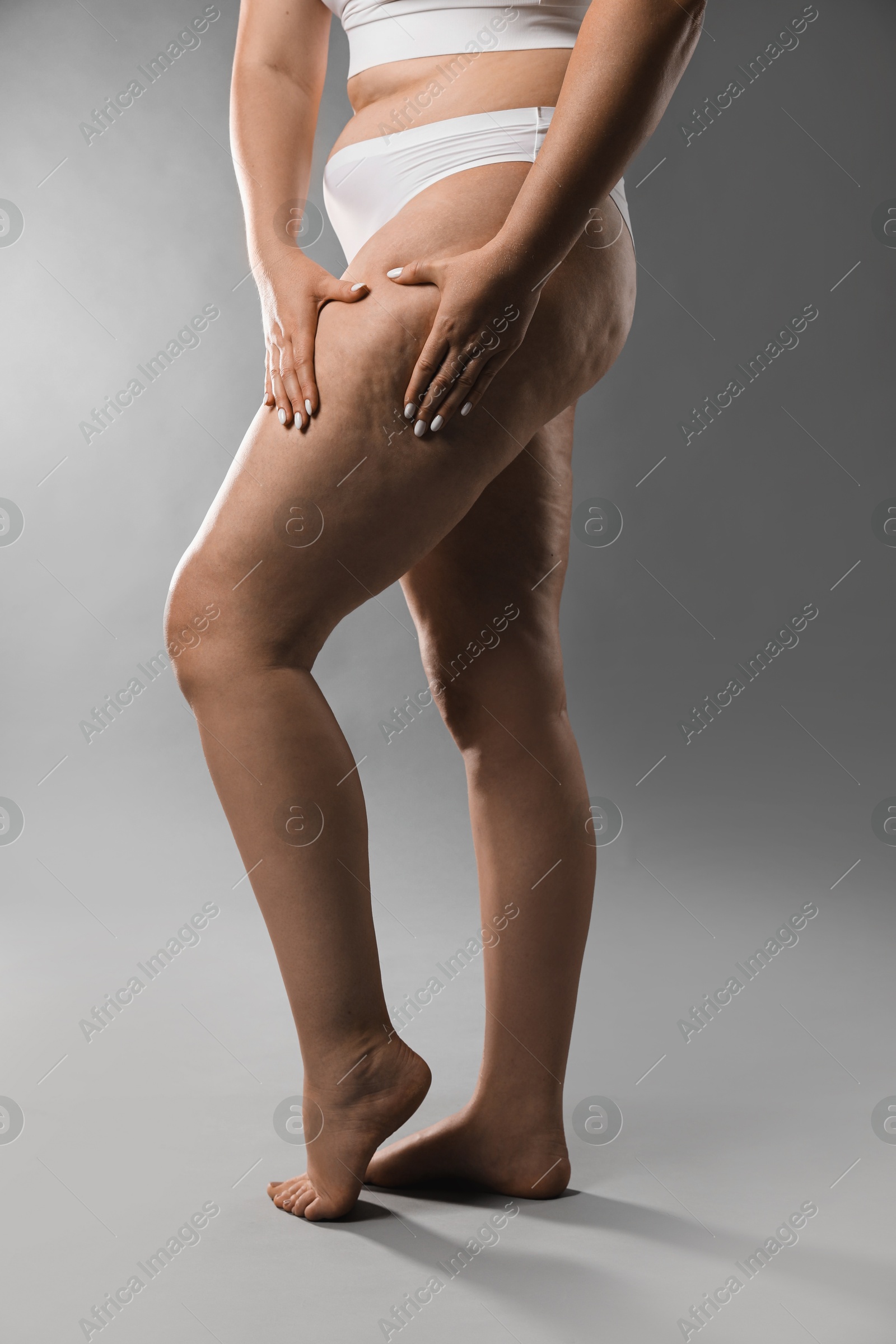 Photo of Woman with cellulite on grey background, closeup