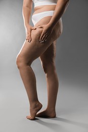 Woman with cellulite on grey background, closeup