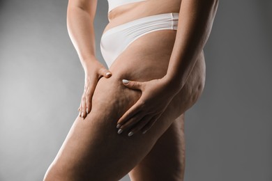 Woman with cellulite on grey background, closeup