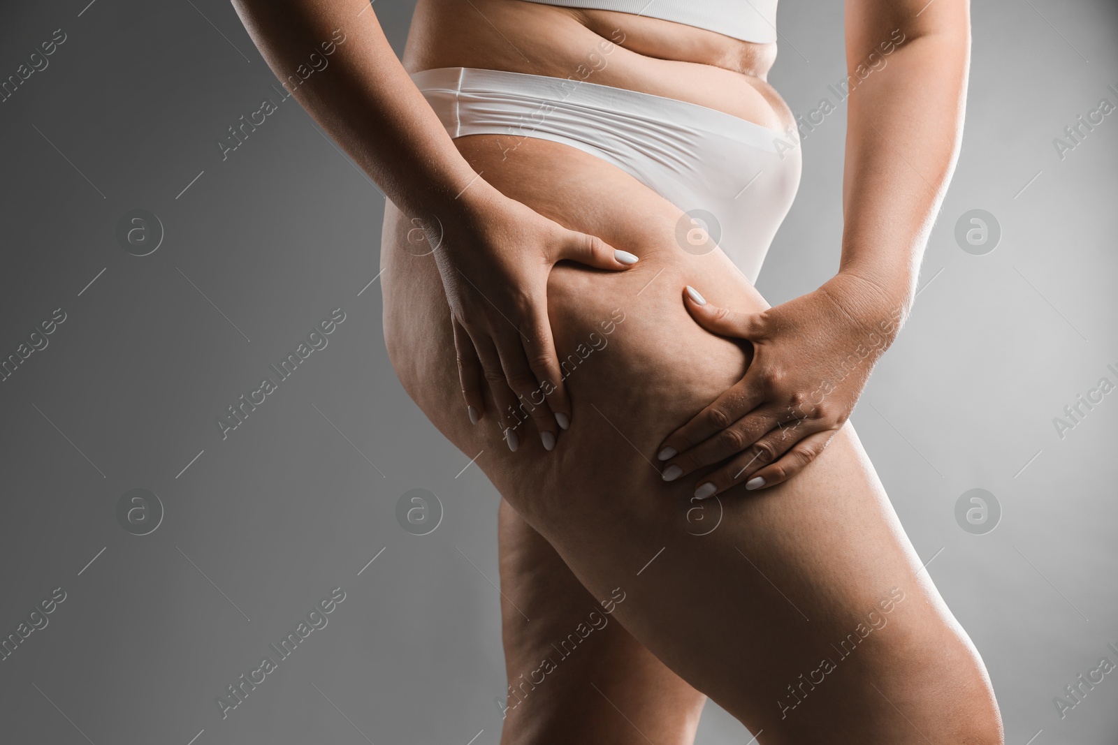 Photo of Woman with cellulite on grey background, closeup. Space for text