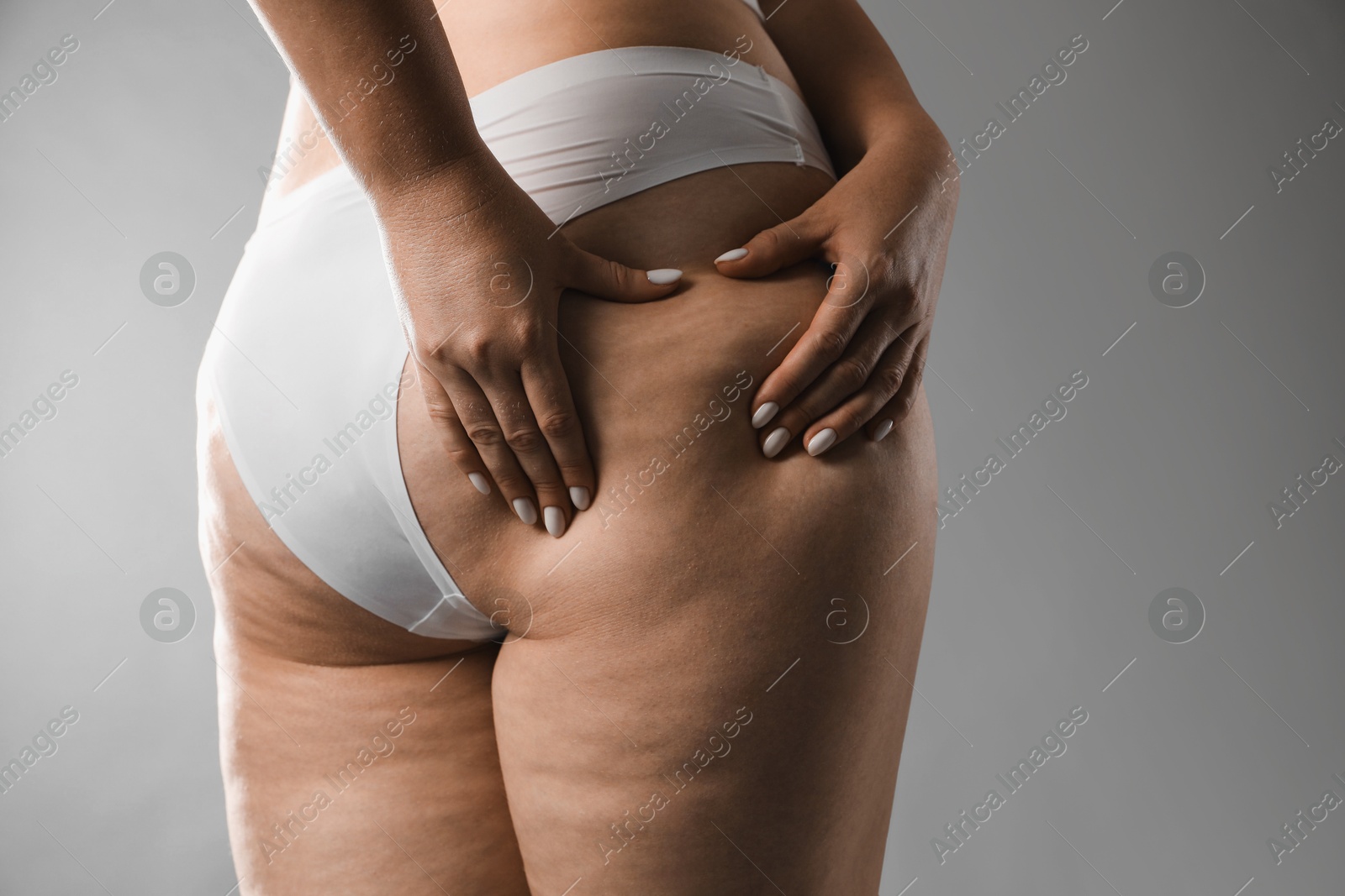 Photo of Woman with cellulite on grey background, closeup. Space for text