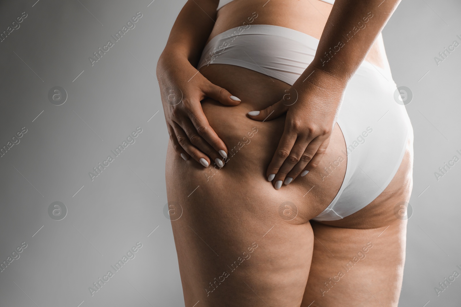 Photo of Woman with cellulite on grey background, closeup. Space for text