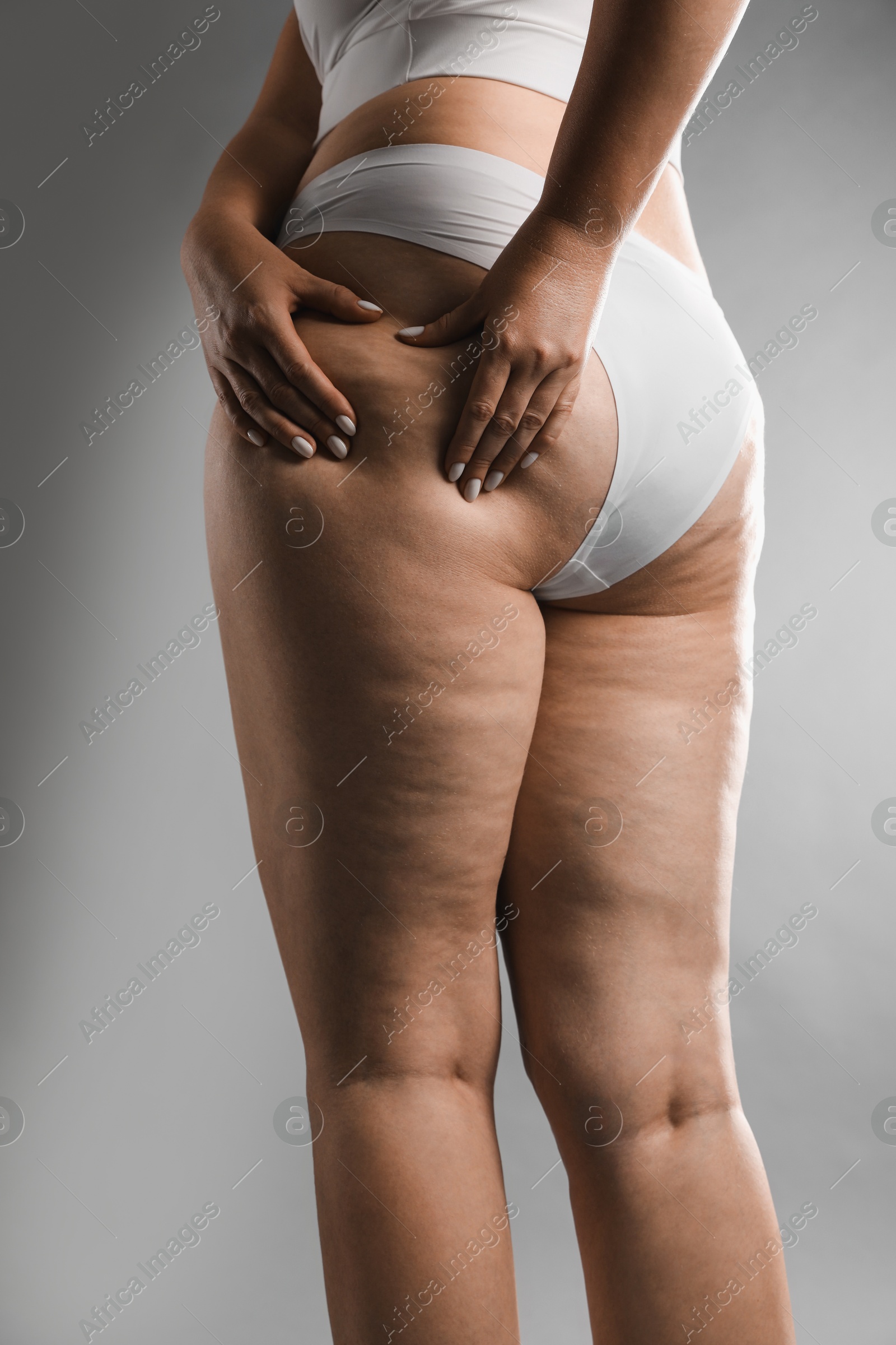 Photo of Woman with cellulite on grey background, closeup