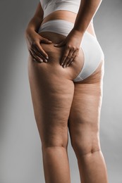 Woman with cellulite on grey background, closeup