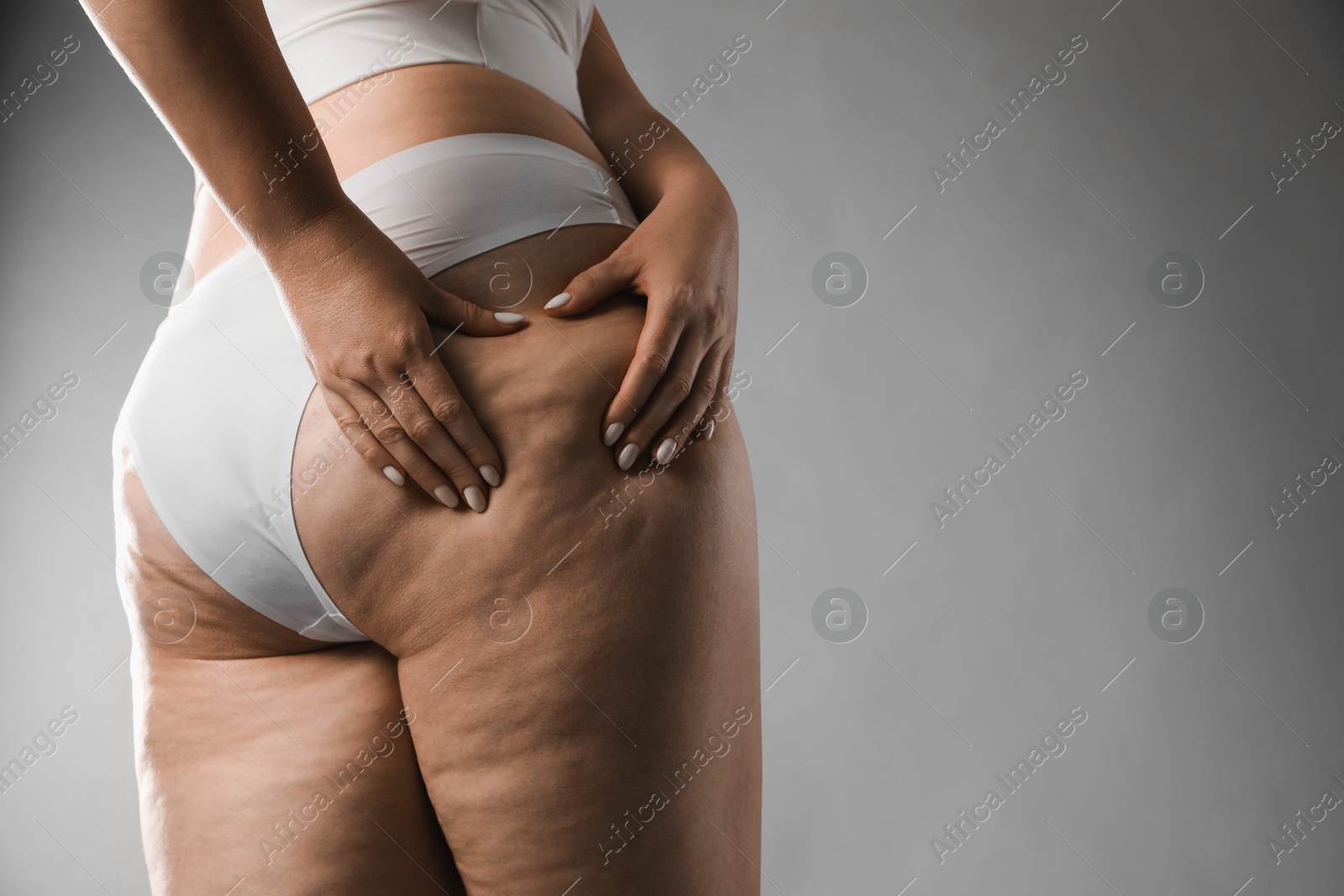 Photo of Woman with cellulite on grey background, closeup. Space for text