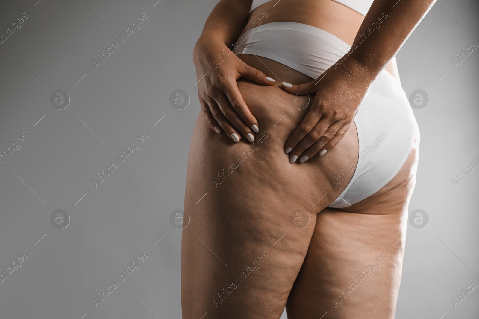 Photo of Woman with cellulite on grey background, closeup. Space for text