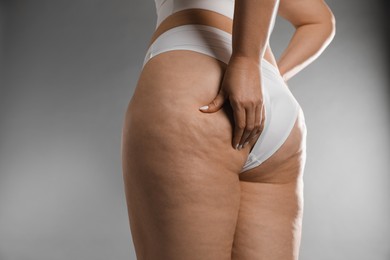 Woman with cellulite on grey background, closeup. Space for text