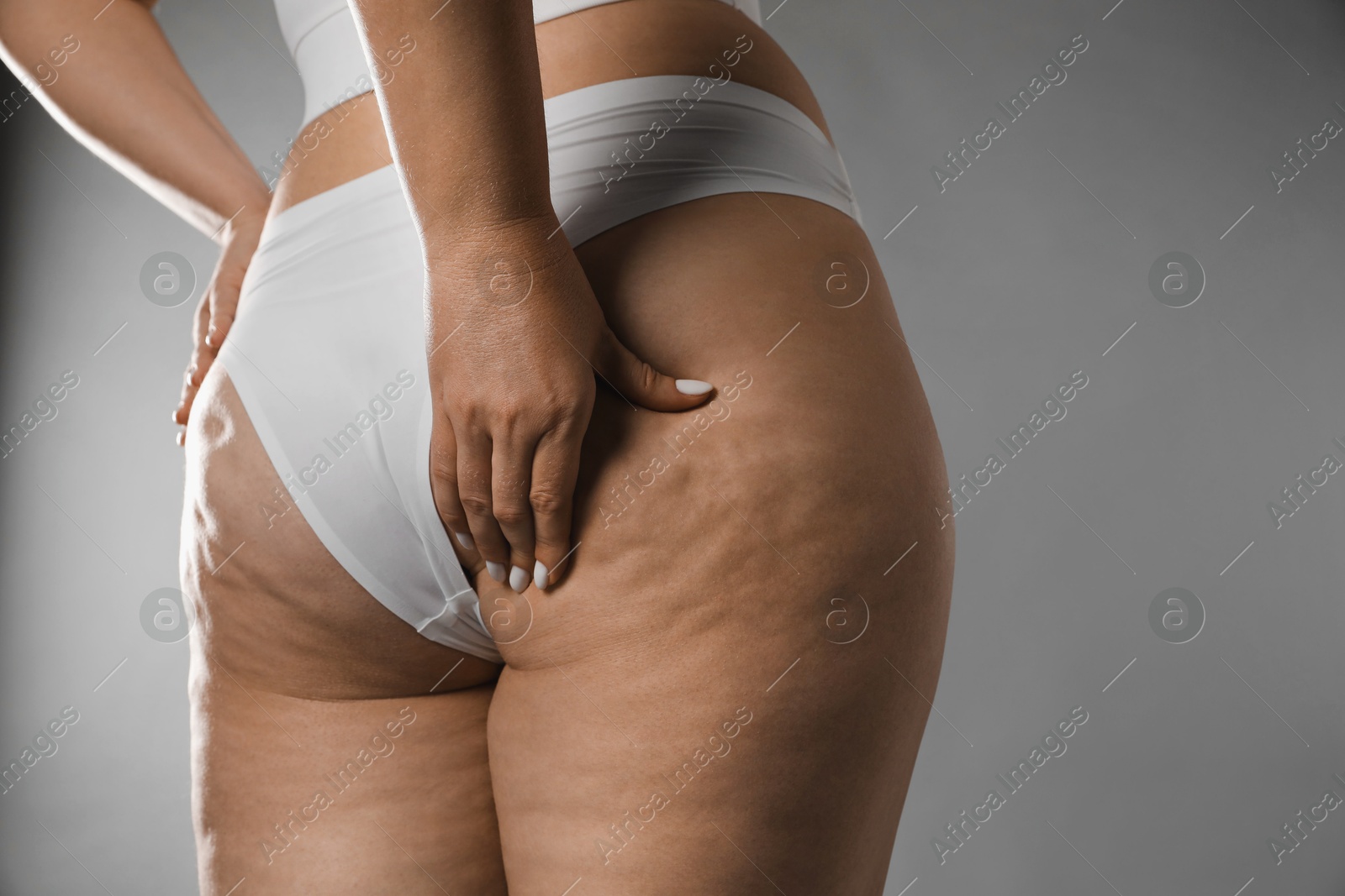 Photo of Woman with cellulite on grey background, closeup. Space for text