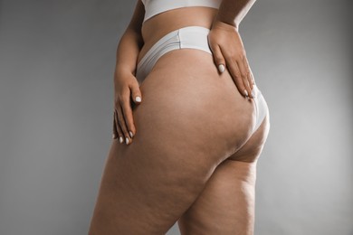 Woman with cellulite on grey background, closeup