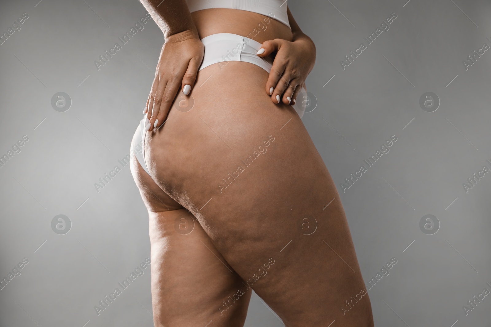 Photo of Woman with cellulite on grey background, closeup