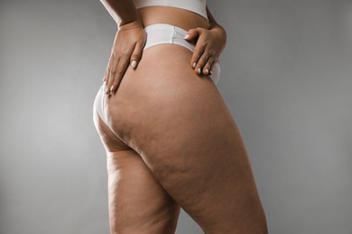 Woman with cellulite on grey background, closeup